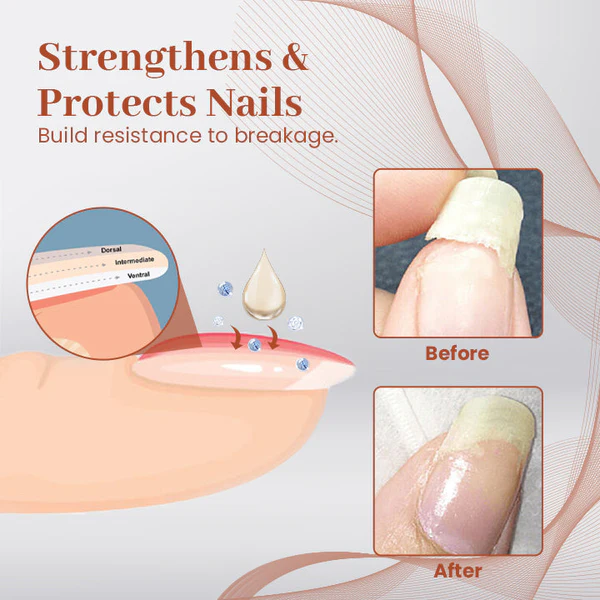 Ceoerty™ PROStrength Ultimate Nail Repair Serum - Image 4