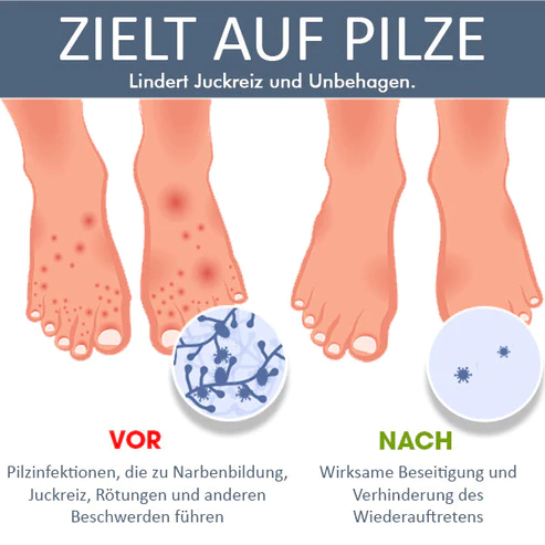 MediCure™ Fußpflege-Brausetabletten - Image 7