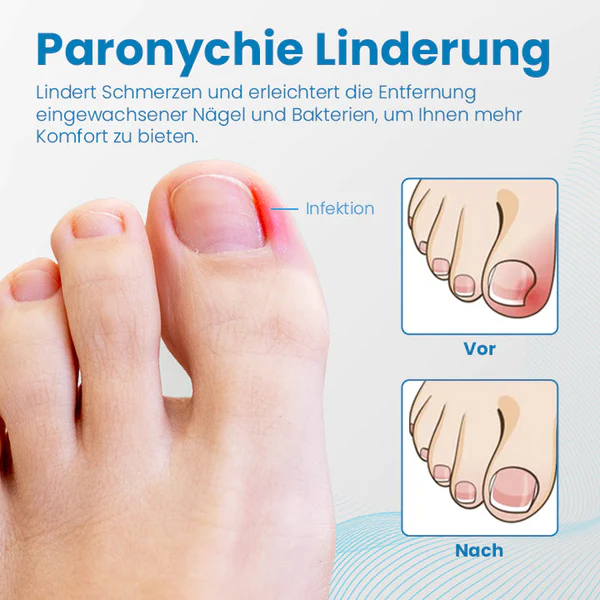 Ceoerty™ Anti-Paronychia Nagelbehandlungs-Gel - Image 6