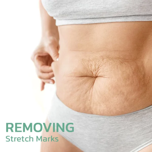 BeYou™ Women Collagen Lifting Body Oil - Image 3