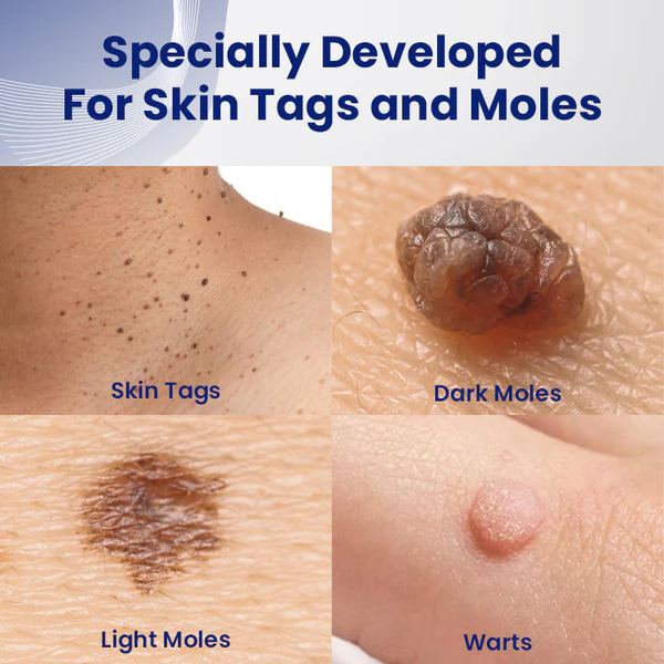 Ceoerty™ WartsErase Blemish Skin Remover Cream - Image 5