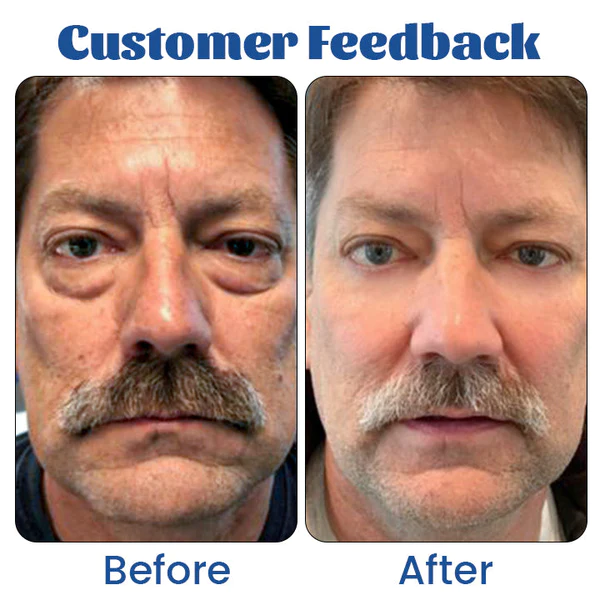 Biancat™ Retinol Renewal Eye Cream - Image 5