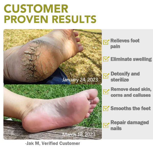 AEXZR™ Foot Medication Effervescent Pills - Image 4