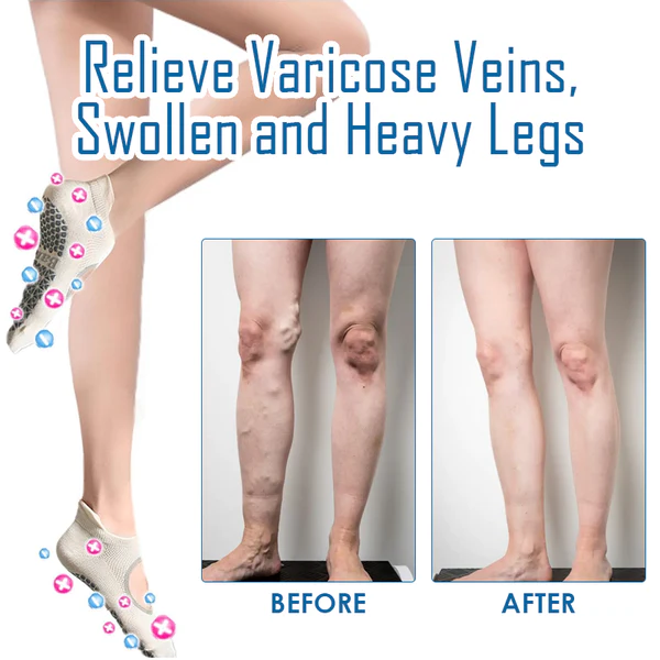 Ricpind IONIC Tourmaline CallusHealing Socks - Image 3