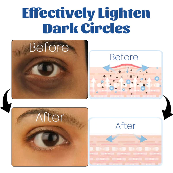 Biancat™ Retinol Renewal Eye Cream - Image 3