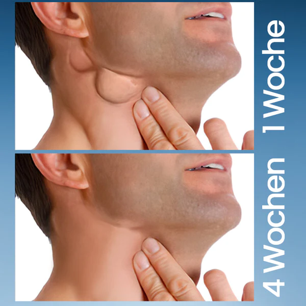 Ceoerty™ ThyroHeal Schilddrüsenlymphknoten-Patch - Image 4