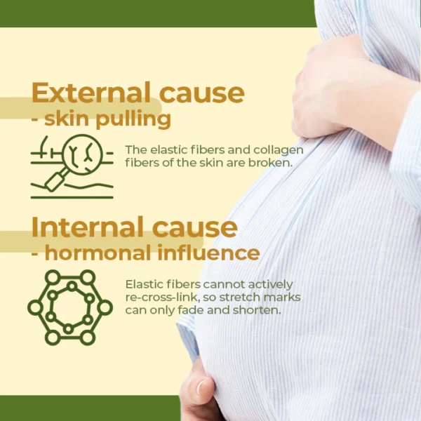 XRoland™ Olive Stretch Mark Treatment Oil - Image 3