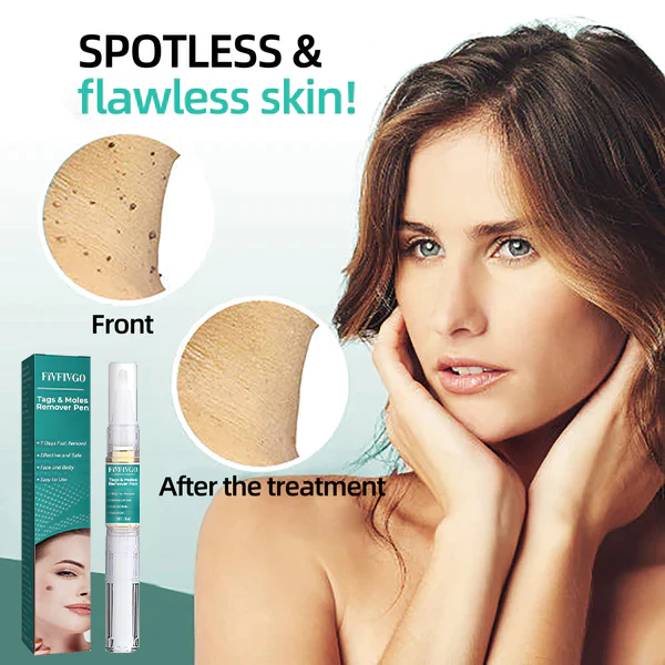 Fivfivg™ Tags & Muttermale Entferner Stift - Image 4