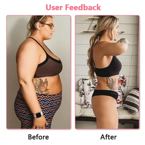 Biancat™ Lymphatic Drainage Shaping Bra - Image 3