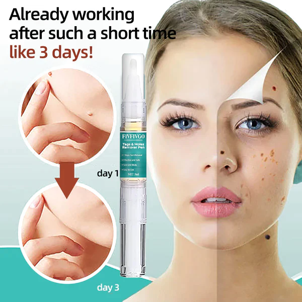 Fivfivg™ Tags & Muttermale Entferner Stift - Image 3