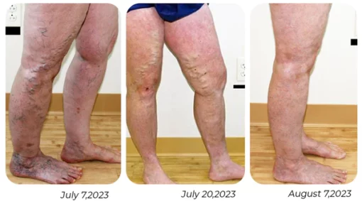 GFOUK™ VascuCare Vein Comfort Spray - Image 6