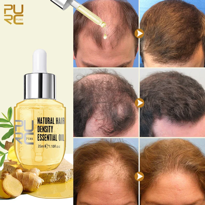 💥2023 New Hair Growth Essential Oil – Reclaim Your Luscious Locks!【🔥Buy 1 Get 1 Free🔥】 - Image 2