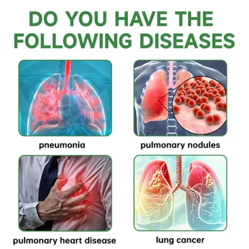 Furzero™️ RespiClean Herbal Lung and Breath Spray - Image 9