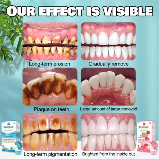 Whitexa™ Comprehensive Oral Care Mouthwash - Image 7