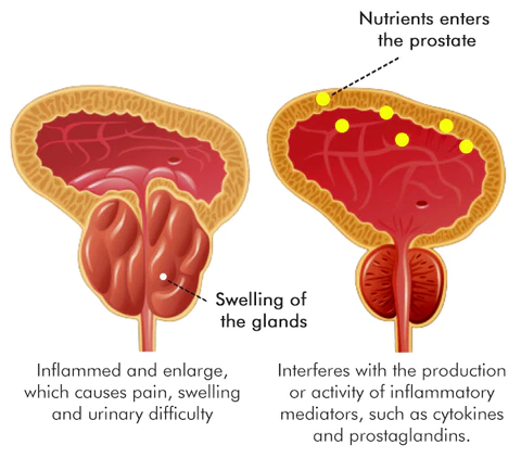 Biancat™ ProstoCare Prostate Support Drops - Image 7