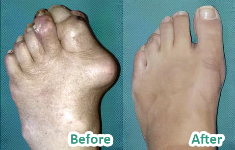 PRO Crema curativa para el dolor y los huesos con veneno de abeja - Image 6