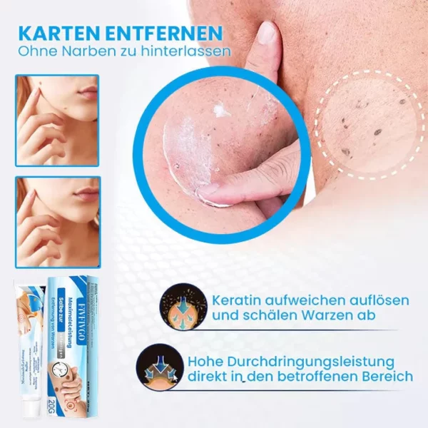 MaximaleLeistung Salbe zur sofortigen Entfernung von Warzen - Image 4
