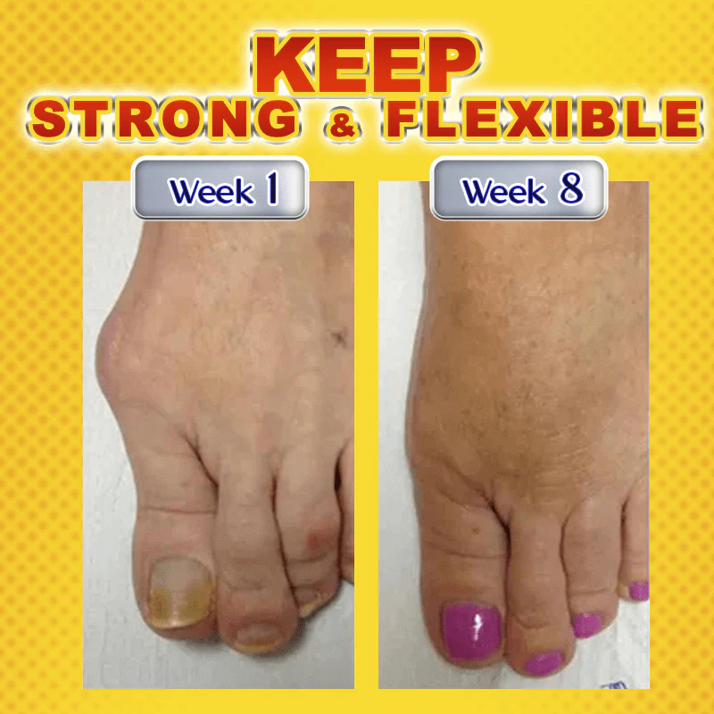 MovingFree™ Joint & Bone Therapy Bee Venom Treatment Gel - Image 4