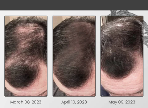 Ceoerty™ LocksGuard Anti-Hairloss Spray - Image 6