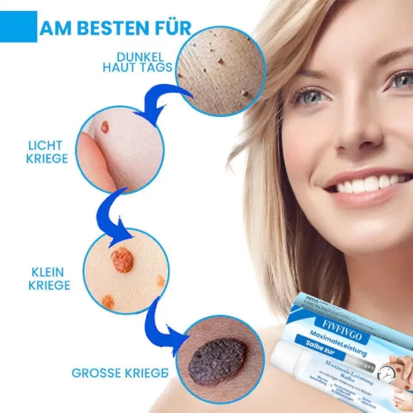 MaximaleLeistung Salbe zur sofortigen Entfernung von Warzen - Image 7