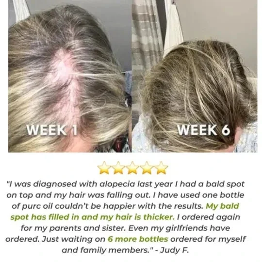 💥2023 New Hair Growth Essential Oil – Reclaim Your Luscious Locks!【🔥Buy 1 Get 1 Free🔥】 - Image 10