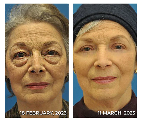 flysmus™ RadiantEyes Collagen Lifting Eye Balm Stick - Image 4