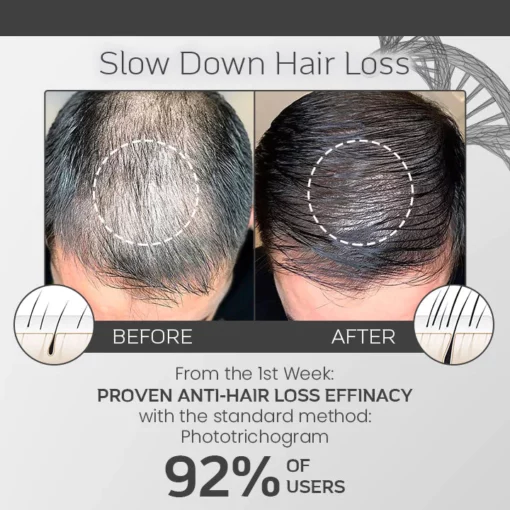 Ceoerty™ LocksGuard Anti-Hairloss Spray - Image 4