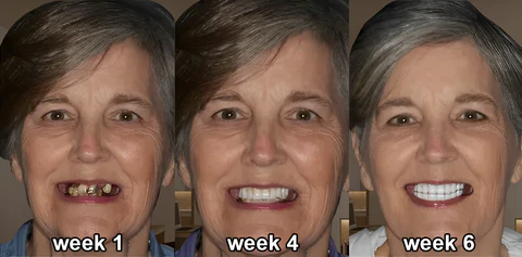 Whitexa™ Comprehensive Oral Care Mouthwash - Image 5