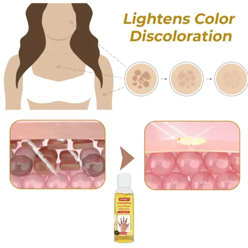 GFOUK™ PeelingPlus Acanthosis Nigricans Therapy Oil - Image 6