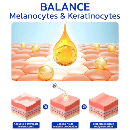 GFOUK™ FastgoVitiligo Soothing Serum - Image 5