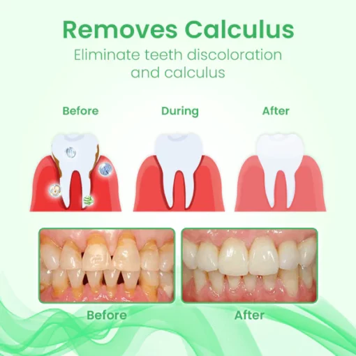 Ceoerty™ OralCure Ampoule Dental Serum - Image 7