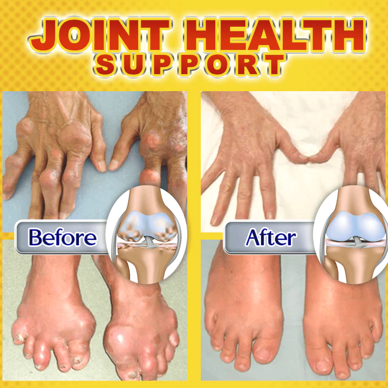 MovingFree™ Joint & Bone Therapy Bee Venom Treatment Gel - Image 5