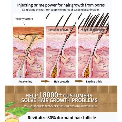 💥2023 New Hair Growth Spray - Fast Hair Growth - Prevent Hair Loss【🔥Buy 1 Get 1 Free🔥】 - Image 6
