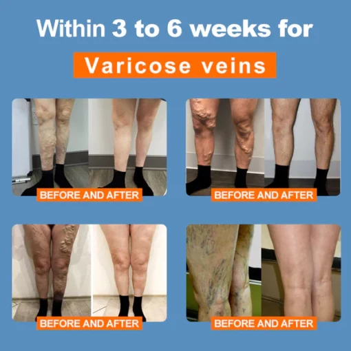 LuckySong® Ionic Ionized Low-Frequency Pulse Self-Heating Socks - Image 7