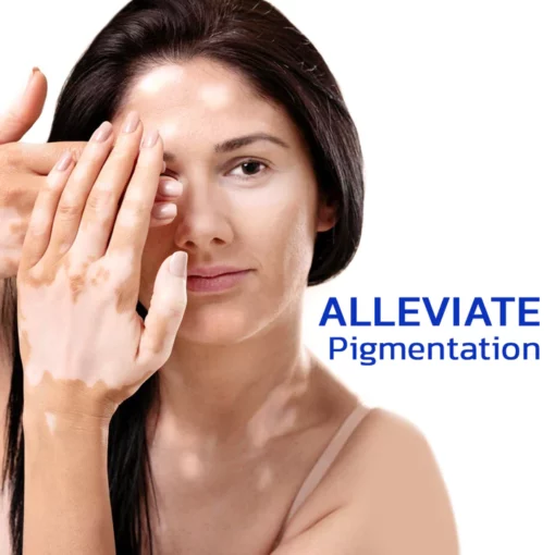 GFOUK™ FastgoVitiligo Soothing Serum - Image 4