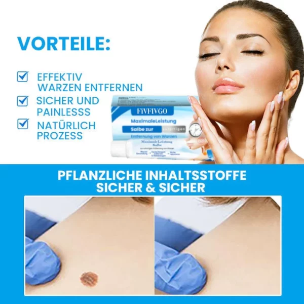 MaximaleLeistung Salbe zur sofortigen Entfernung von Warzen - Image 2
