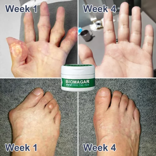 PRO Crema curativa para el dolor y los huesos con veneno de abeja - Image 3