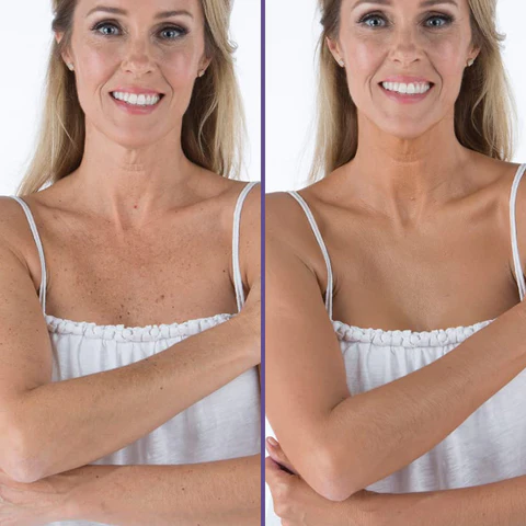 Biancat™ NakedTruth Body Concealer - Image 6