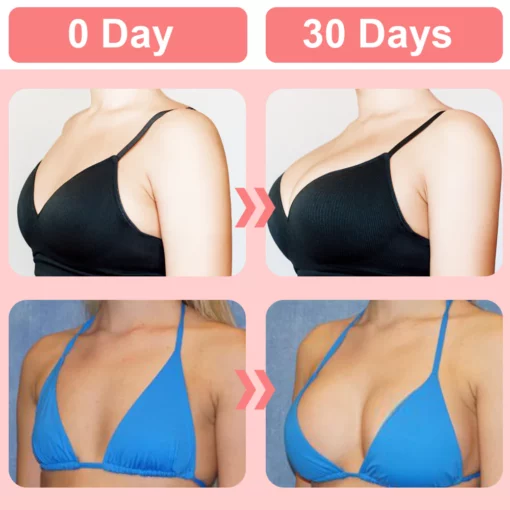 GFOUK™ WingBosom Electric Bust Massager - Image 6