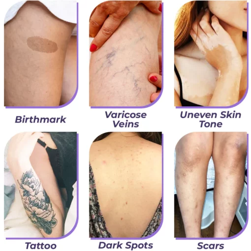 flysmus™ CoverPro Body Concealer - Image 6