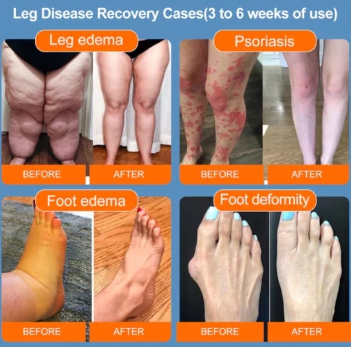 LuckySong® Ionic Ionized Low-Frequency Pulse Self-Heating Socks - Image 5