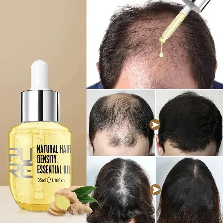 💥2023 New Hair Growth Essential Oil – Reclaim Your Luscious Locks!【🔥Buy 1 Get 1 Free🔥】 - Image 5