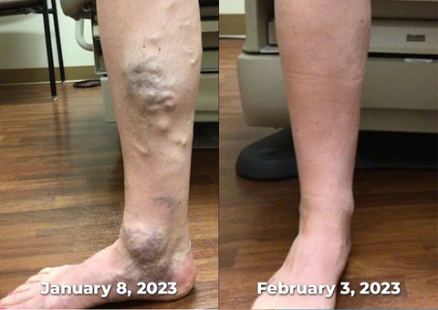 SwellGuard Self-Heating Lymphatic Sleeves - Image 9