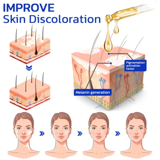 GFOUK™ FastgoVitiligo Soothing Serum - Image 3