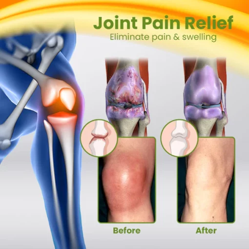 Ceoerty™ BEETox Joint & Bone Therapy Cream - Image 7