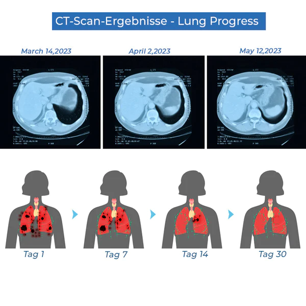 GFOUK™ LungDetox Vernebler-Reinigungsspray - Image 3