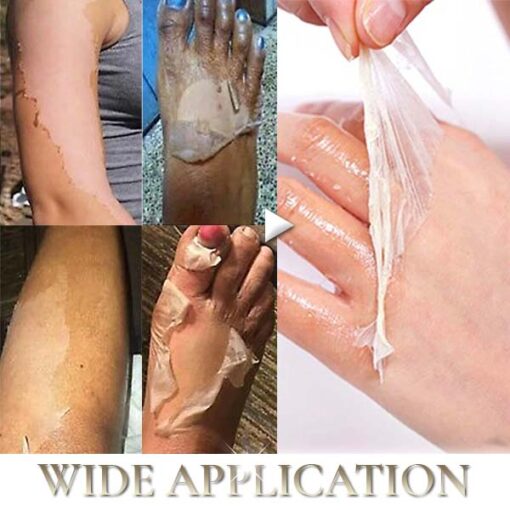 Ceoerty™ ClearSkin PROSpot Yellow Peeling Oil - Image 3