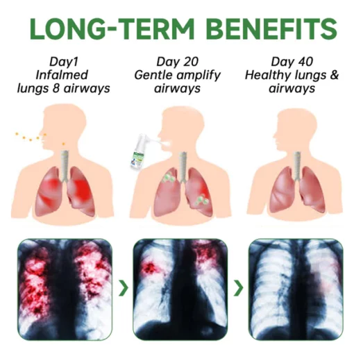 Furzero™️ RespiClean Herbal Lung and Breath Spray - Image 5