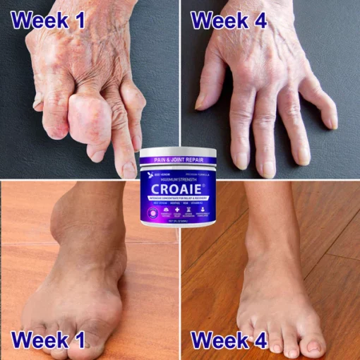 2023 CROAIE® Bee Venom Pain & Joint Repair Cream - Image 4
