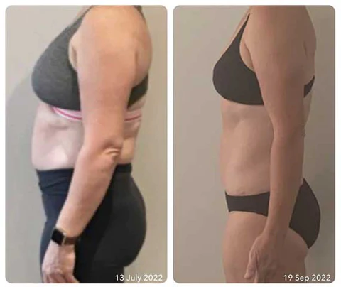 CZTICLE® Lymphvitic Magnetisch Earrings - Image 5